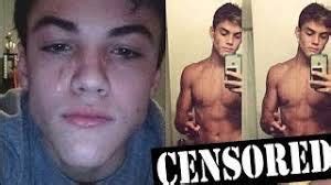 Dolan Twins Nude Penis Pics LEAKED!